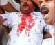 Police-DYFI Gundaism in capital : Number of Hindu activists injured